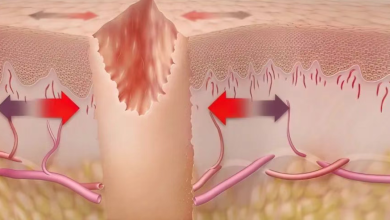 How to Fade Acne and Surgical Scars Without Invasive Procedures: The Herbal Approach